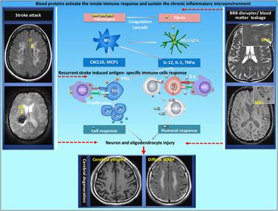 Emerging Role of Immunity in Cerebral Small Vessel Disease